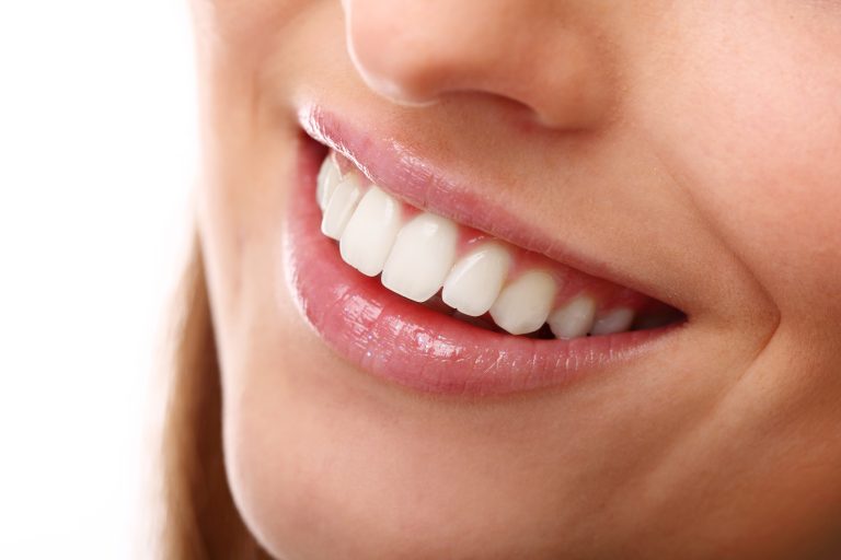 Esthetic Smile Designing